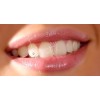 Bijuterii dentare 5 buc - Vertriebsges